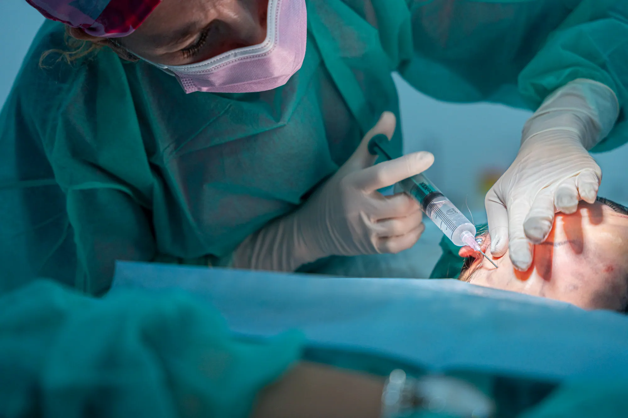 Liposucción de Papada — Medical Linares