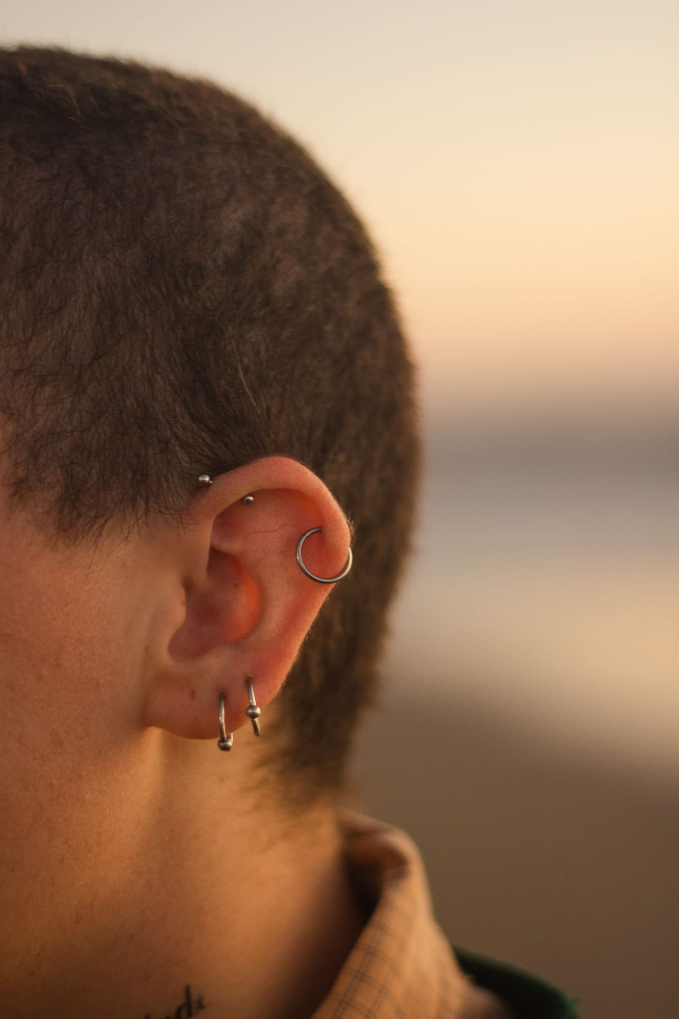 Corrección de Orificios de Piercing — Medical Linares