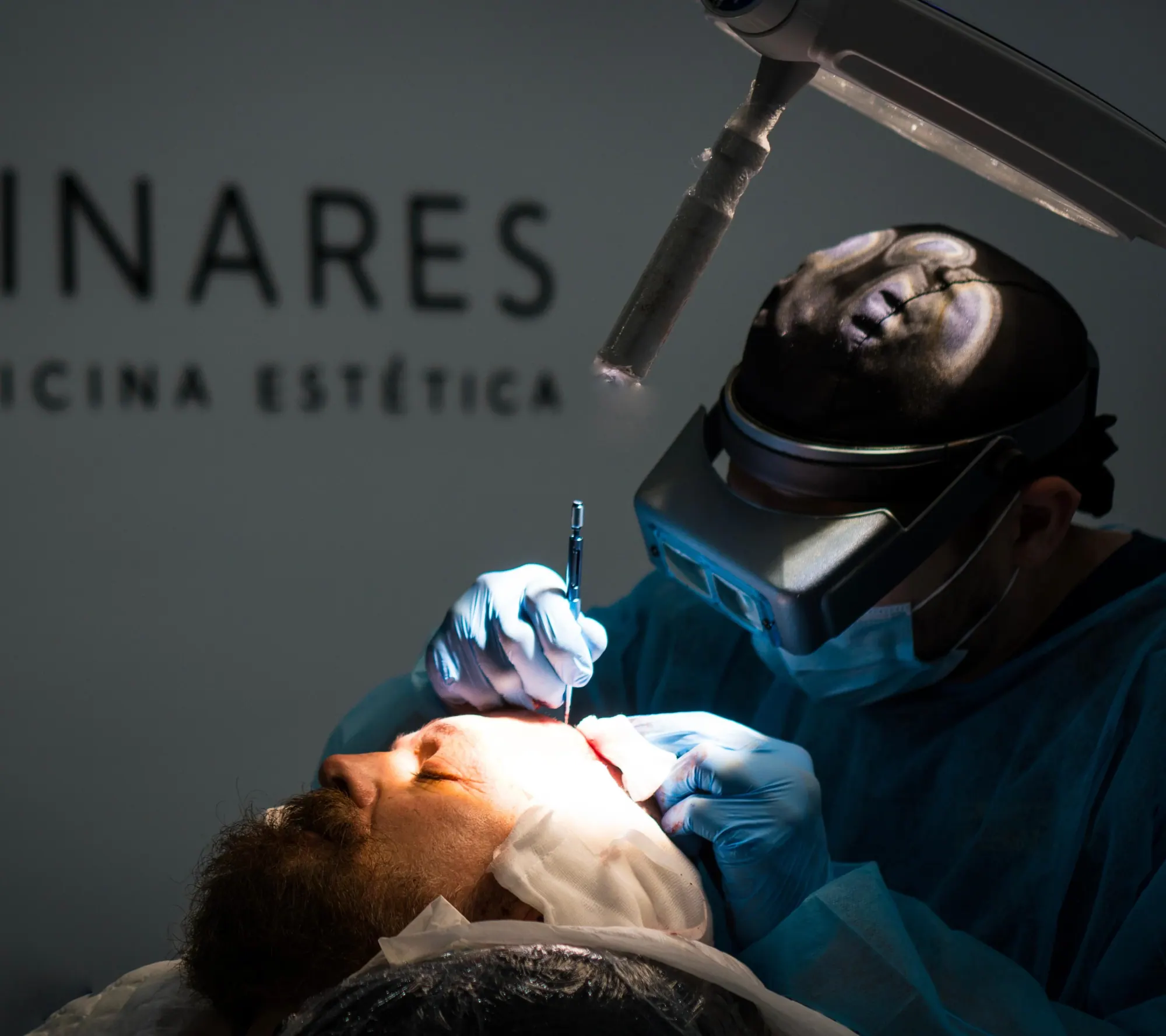 Injerto capilar FUE en Medical Linares