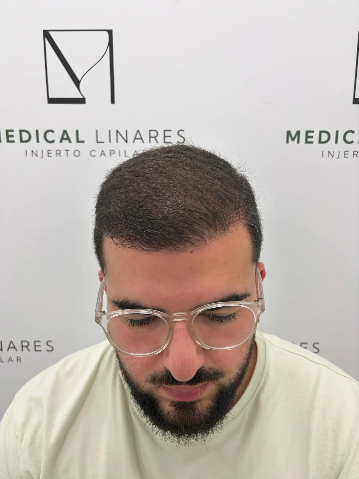 Valoración capilar de un paciente en Medical Linares
