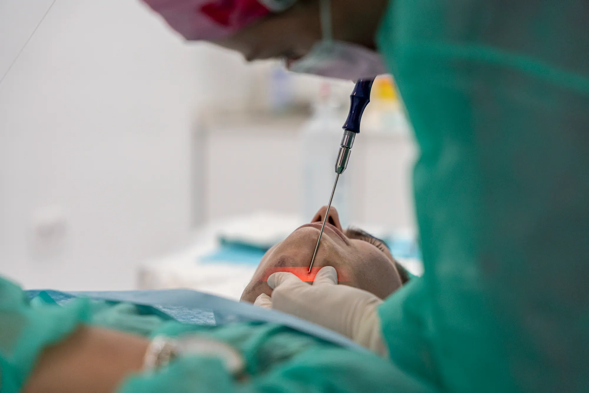 Lipoláser en Medical Linares