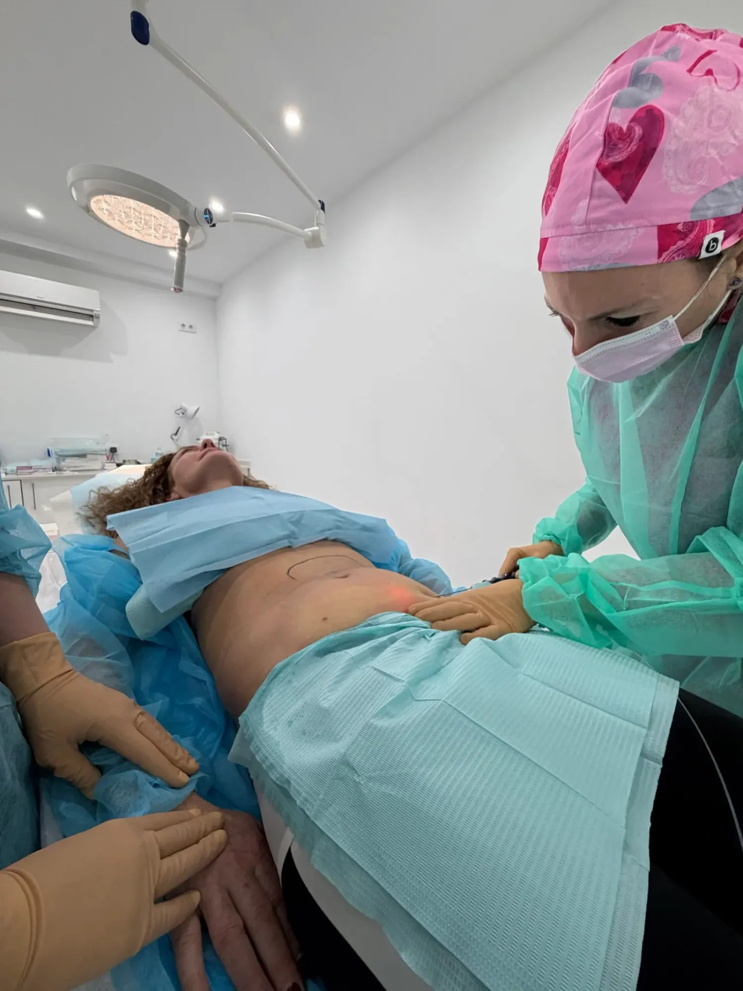 Lipoláser abdominal — Medical Linares