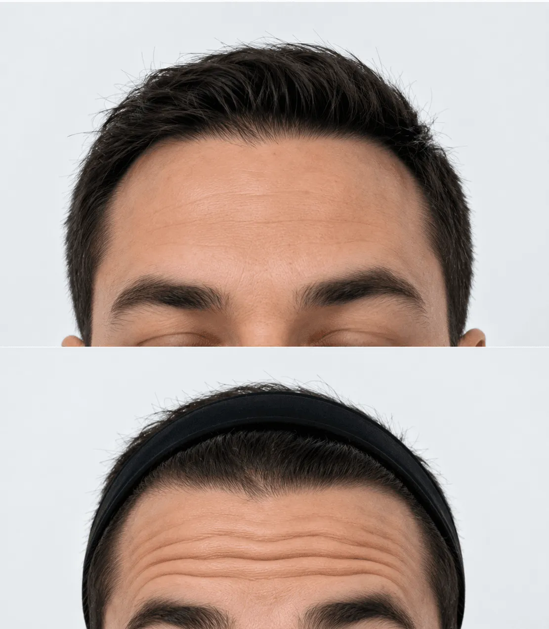 Neuromoduladores en hombres — Medical Linares