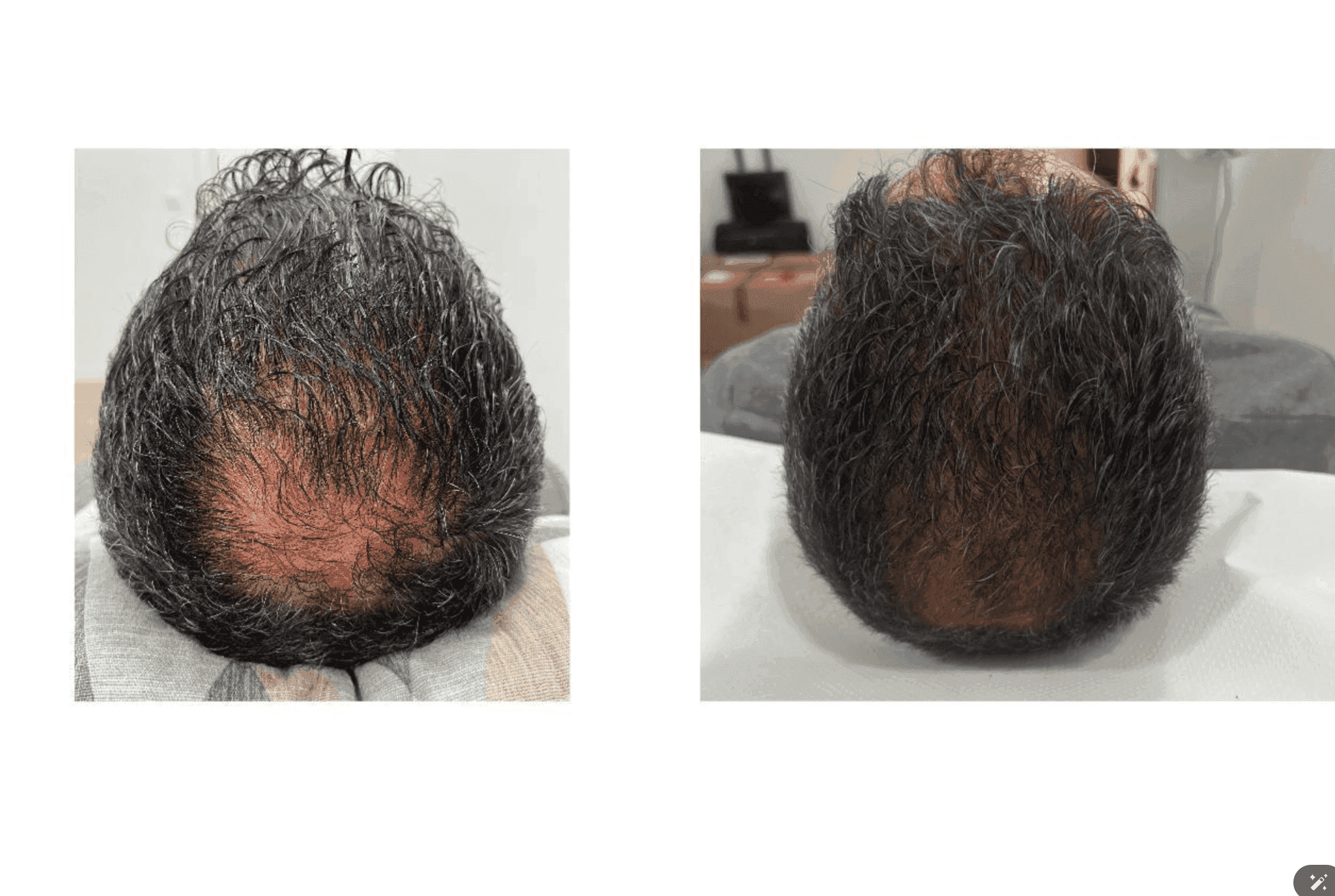 Vasodilatador capilar — Medical Linares