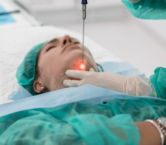 Lipoláser de papada — Medical Linares