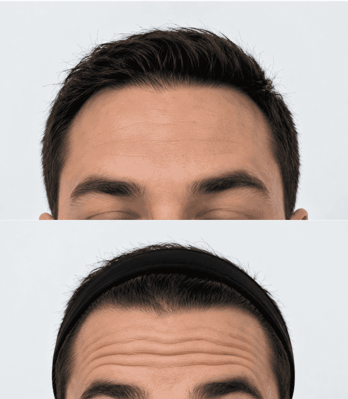 Neuromoduladores en hombres — Medical Linares