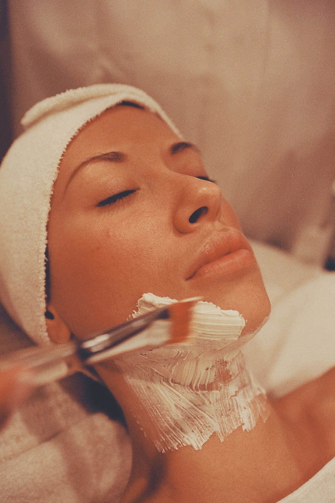 Fotorejuvenecimiento facial — Medical Linares