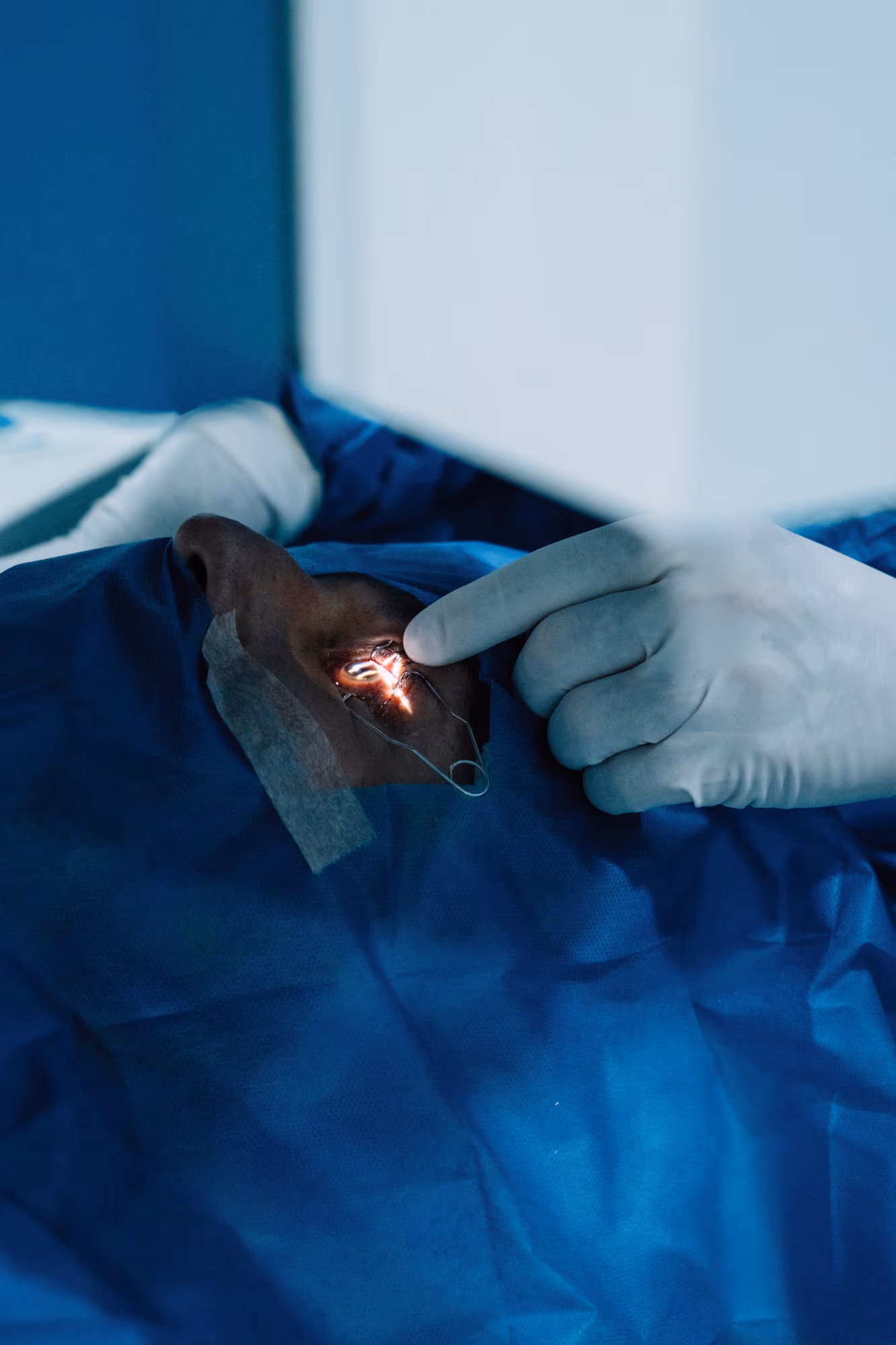 Corrección de Ectropión — Medical Linares