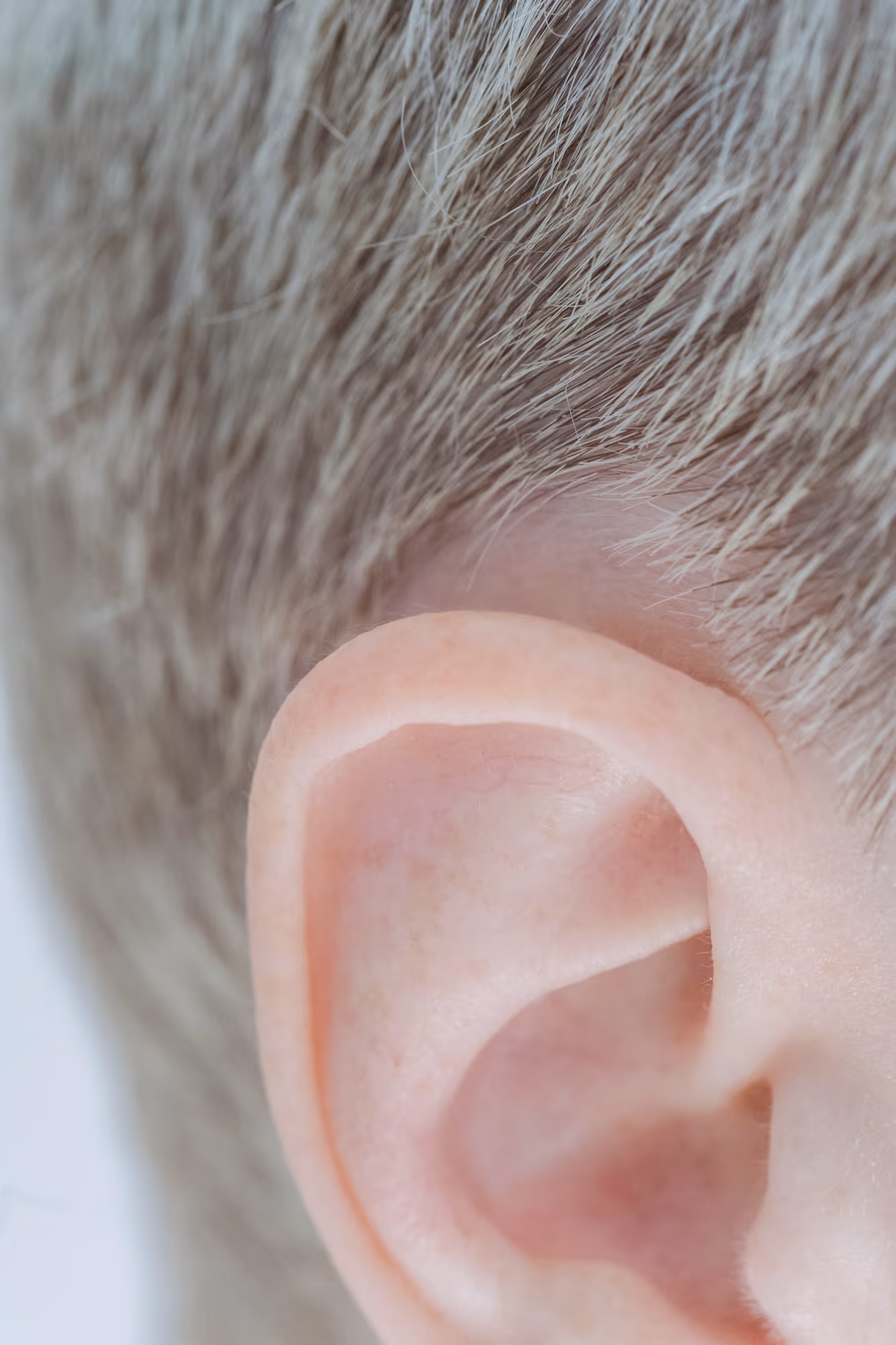 Remodelación del Pabellón Auricular — Medical Linares