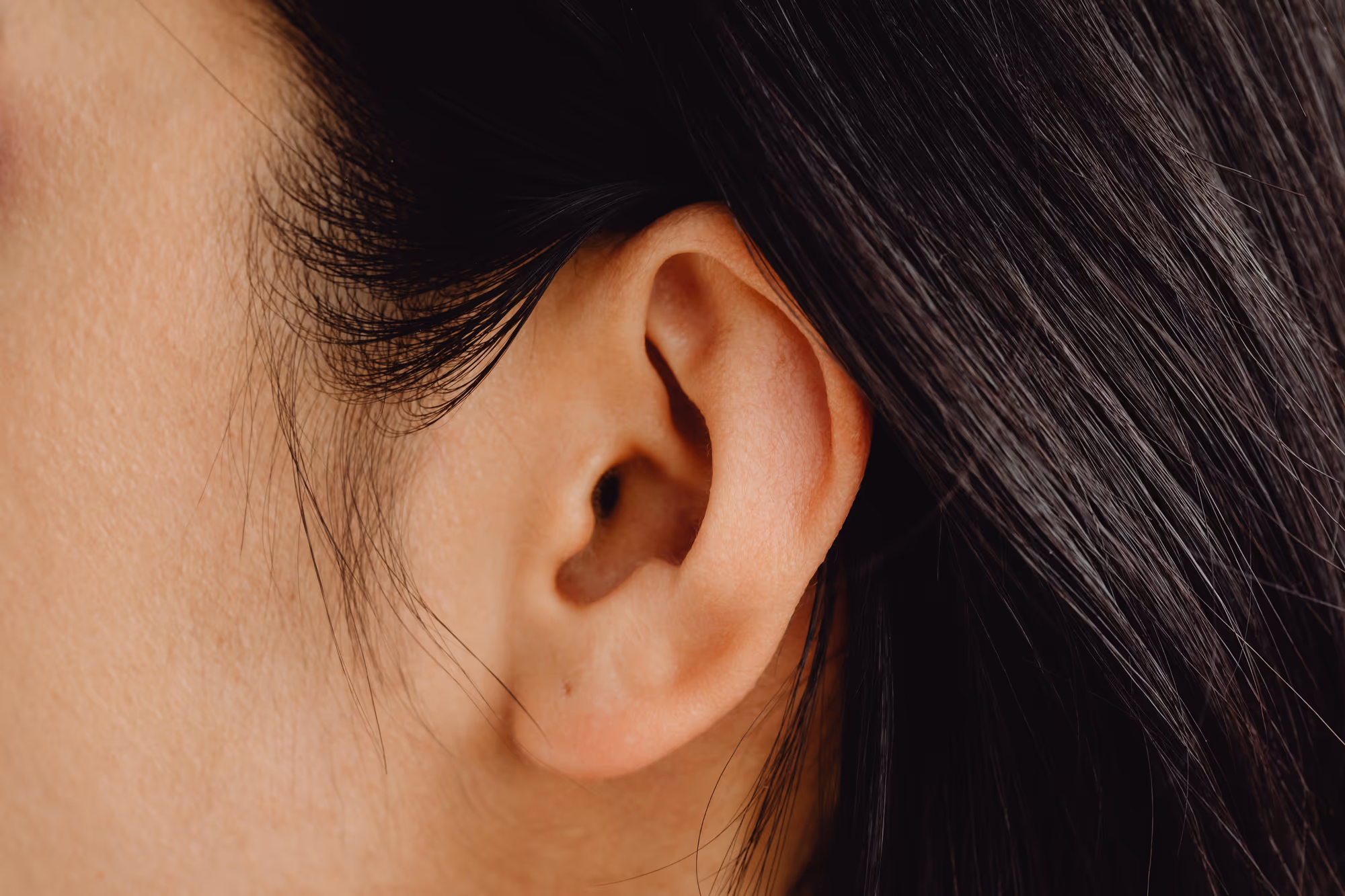 Lobuloplastia — Medical Linares