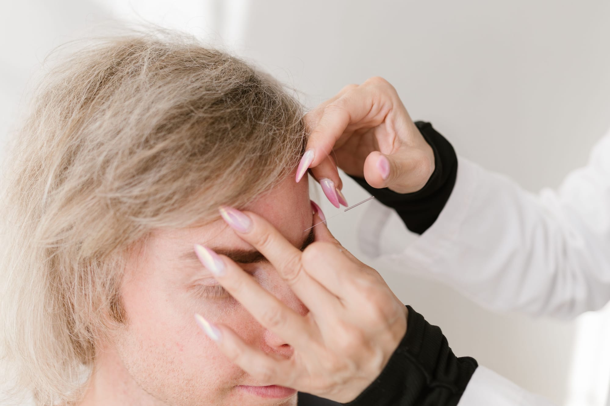 Masculinización facial — Medical Linares