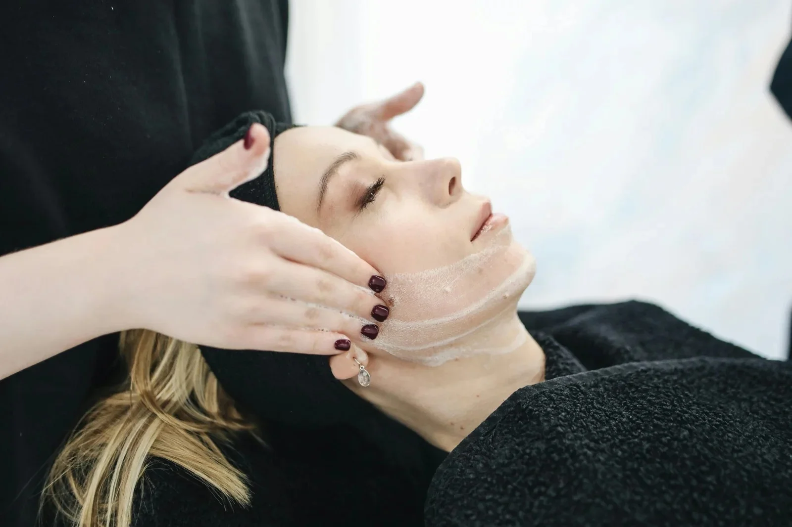 Fotorejuvenecimiento — Medical Linares