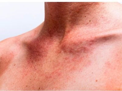 72bed58e-bbbd-452d-91c6-e19c0d56352a