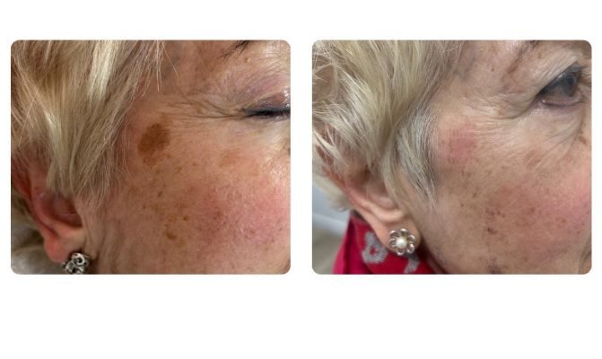 WhatsApp Image 2026-01-22 at 11.54.26