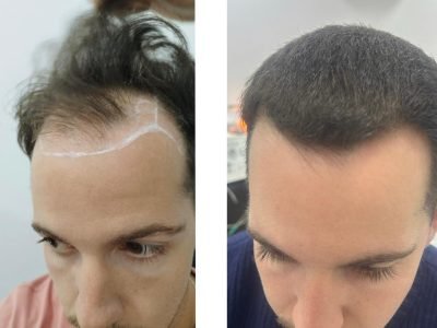 WhatsApp Image 2026-01-22 at 11.54.45