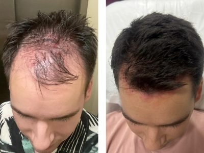 WhatsApp Image 2026-01-22 at 11.54.46