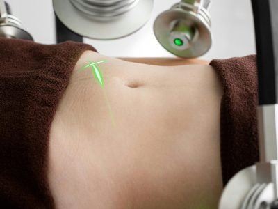 pexels-ganinph-7772643