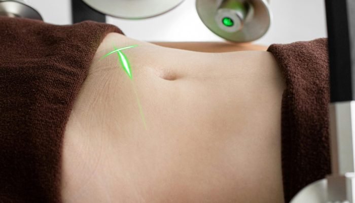 pexels-ganinph-7772643