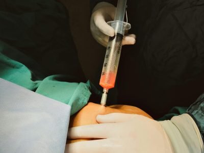 pexels-tkirkgoz-19260387